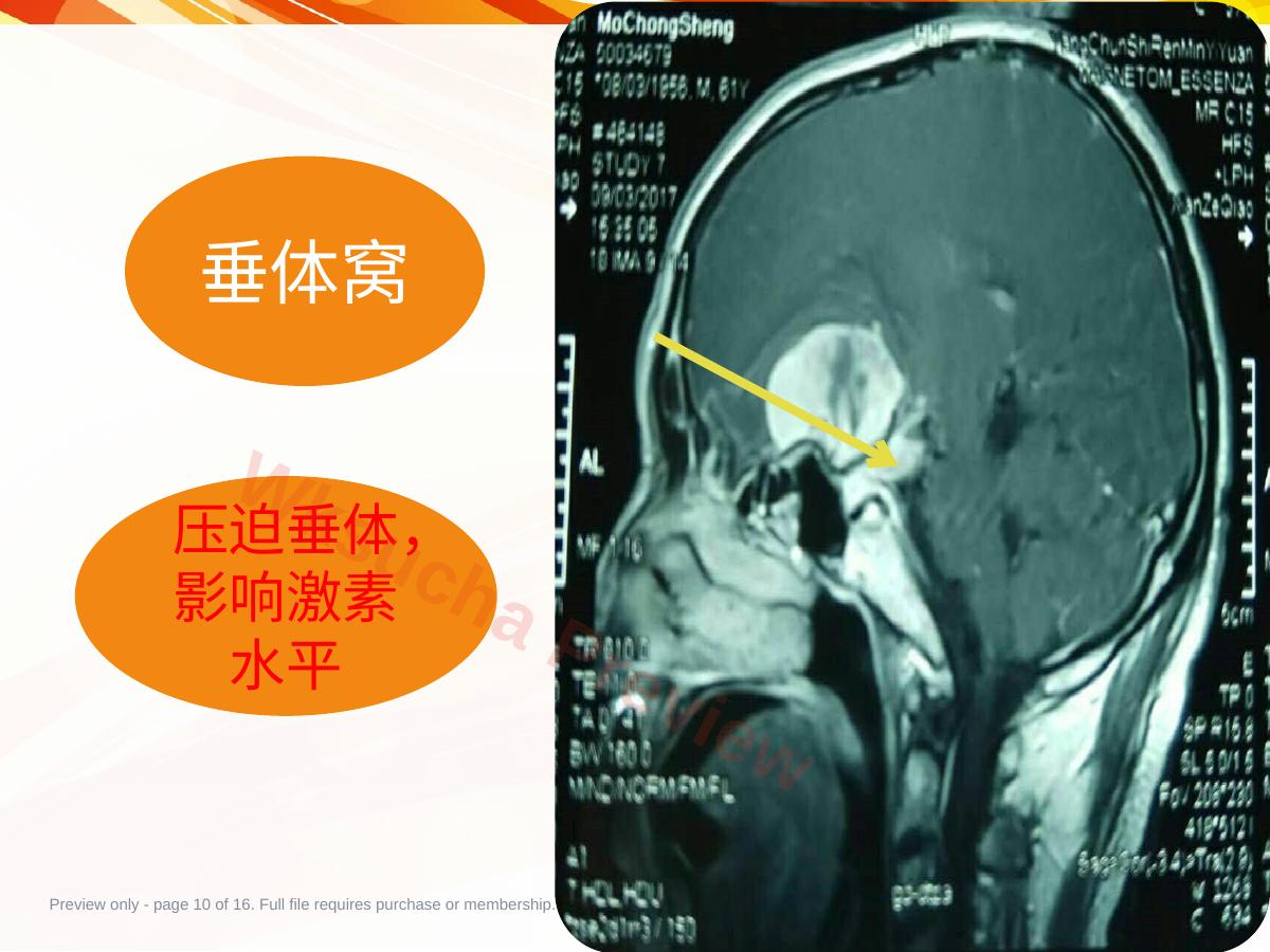 预览第 10 页