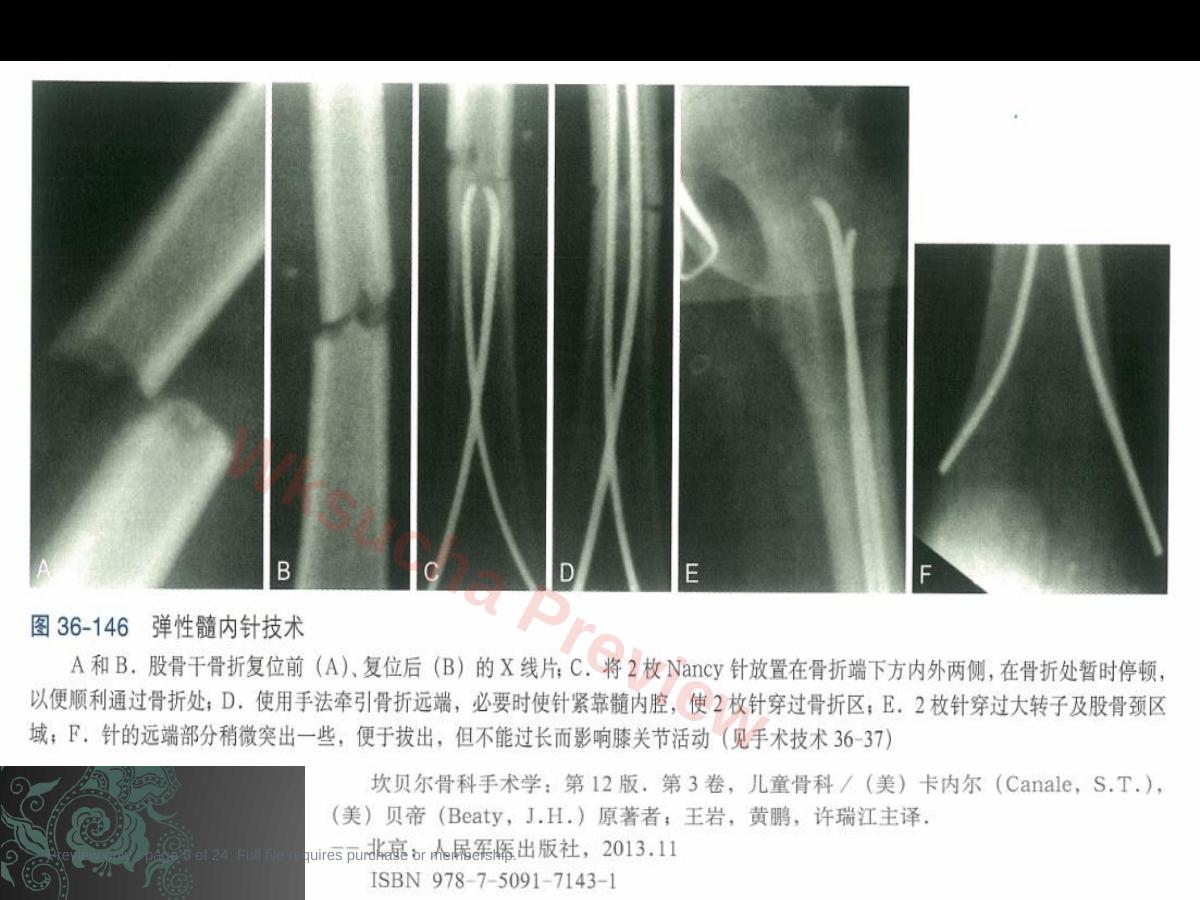预览第 5 页