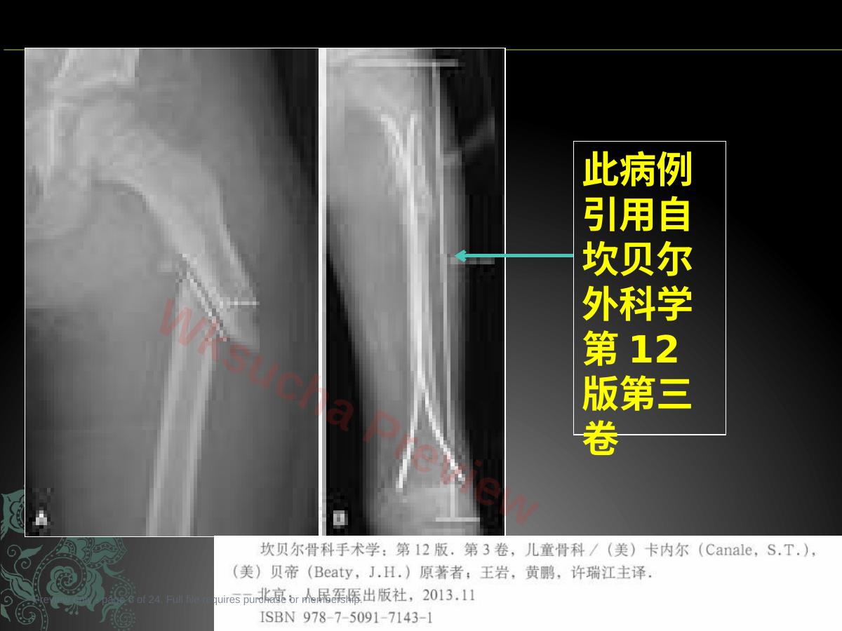 预览第 6 页