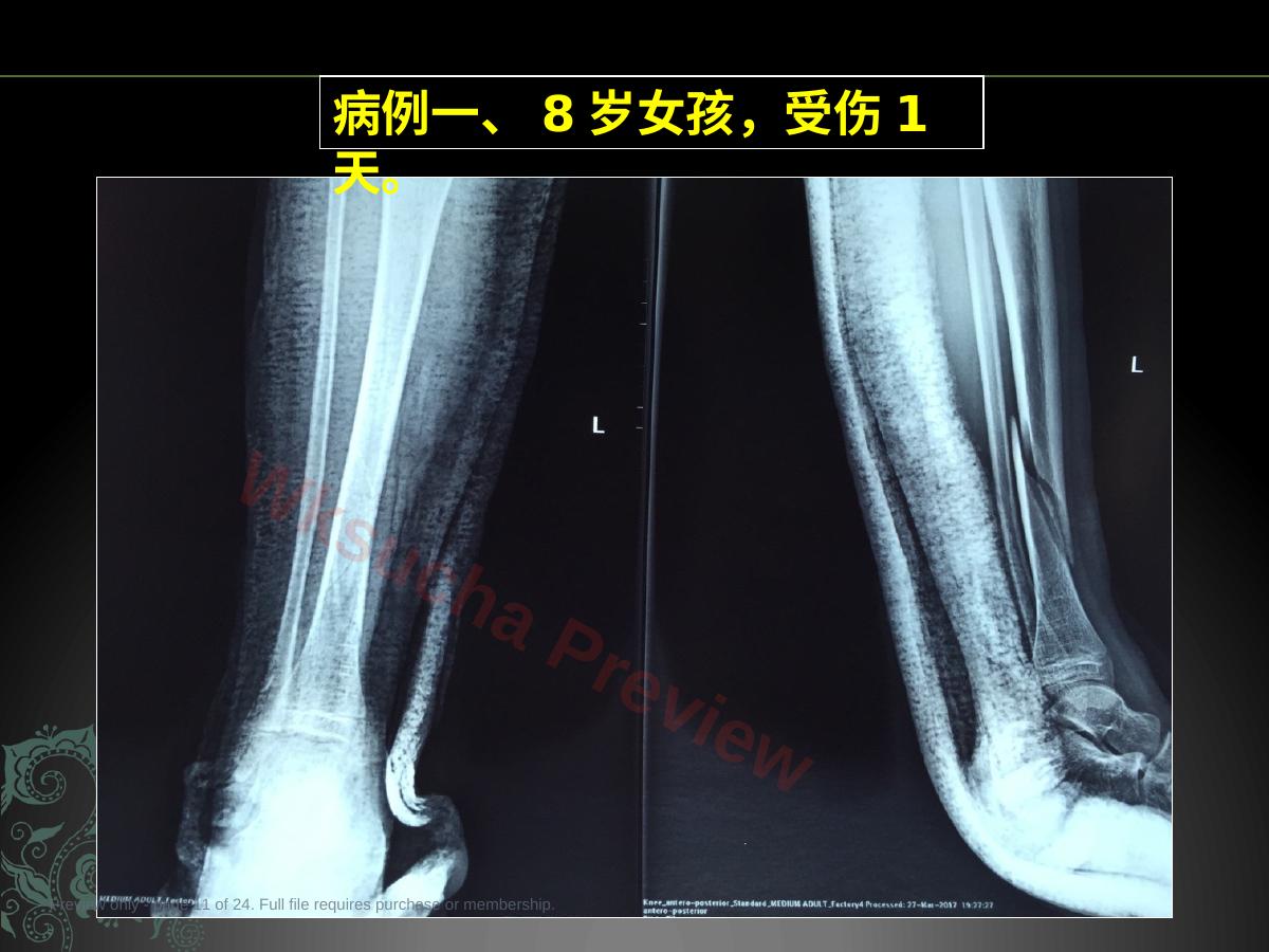 预览第 11 页