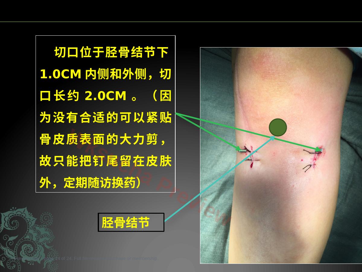 预览第 14 页
