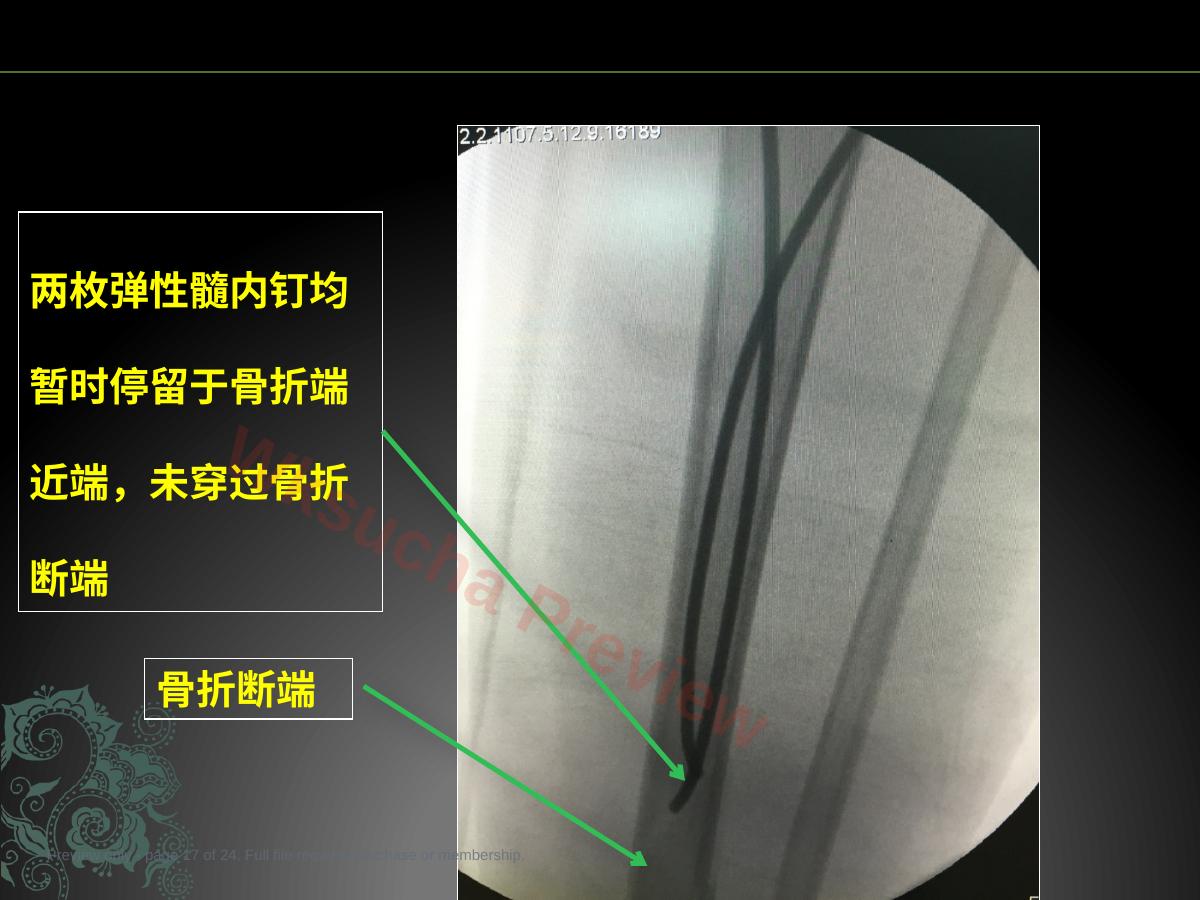 预览第 17 页