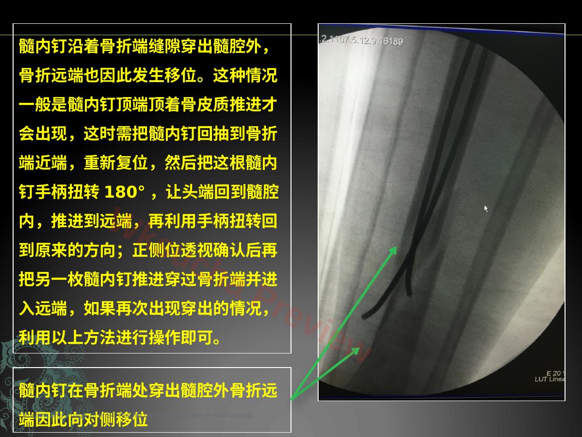 预览第 18 页