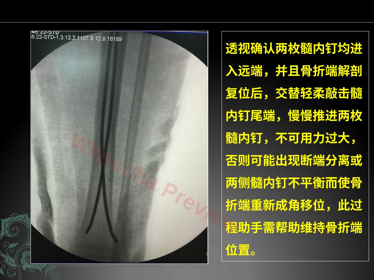 预览第 19 页