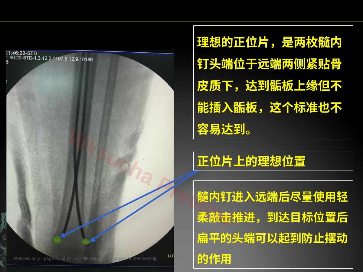 预览第 21 页