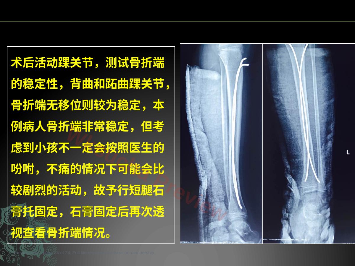 预览第 24 页