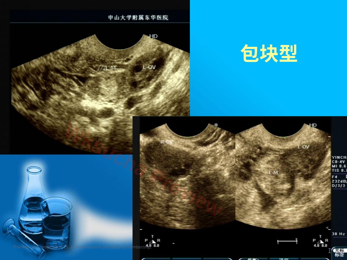 预览第 11 页