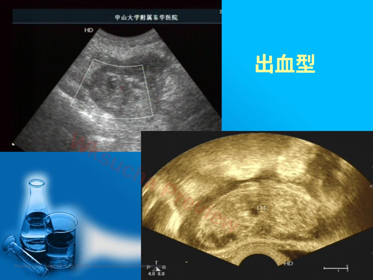 预览第 12 页