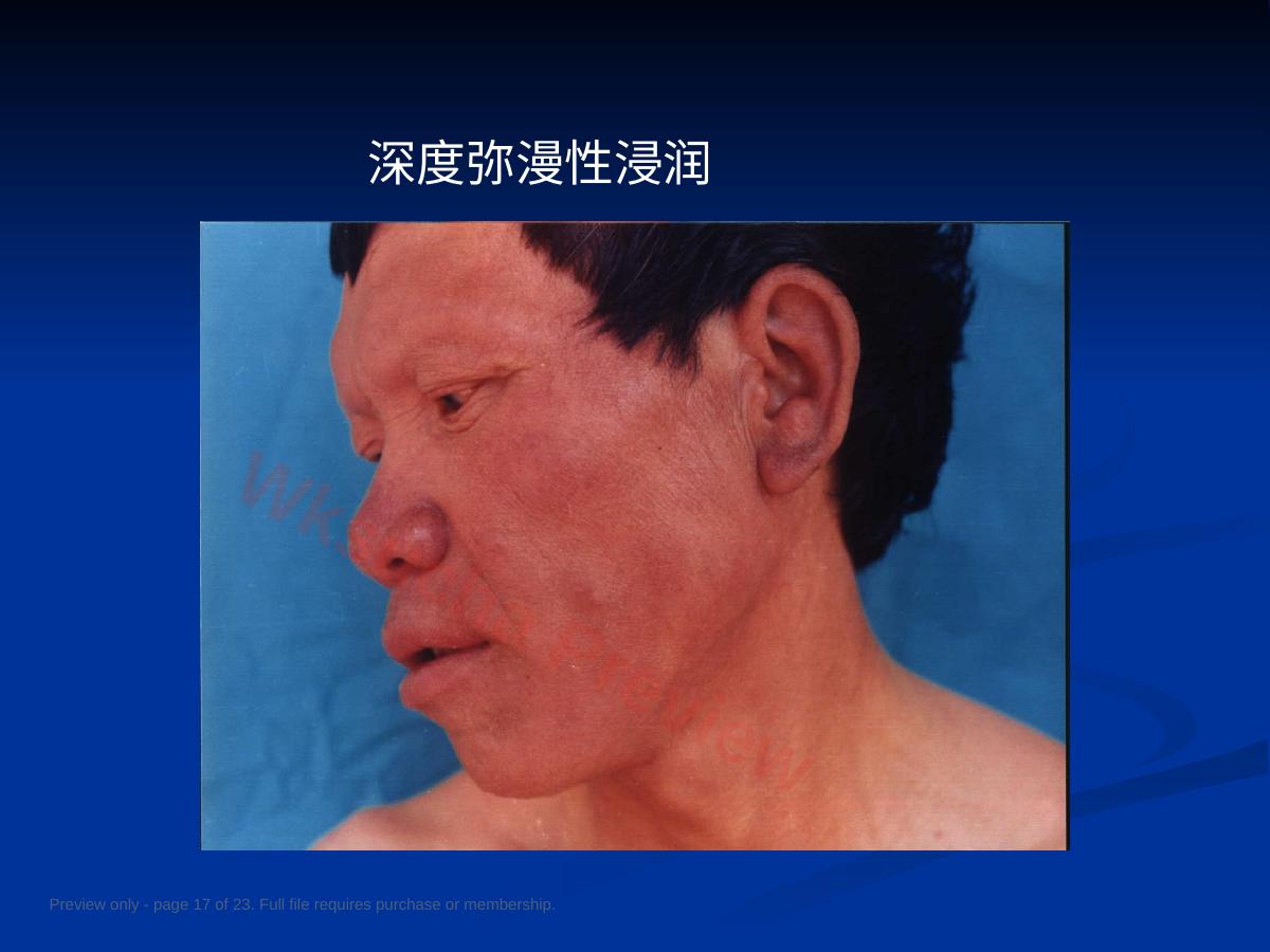 预览第 17 页