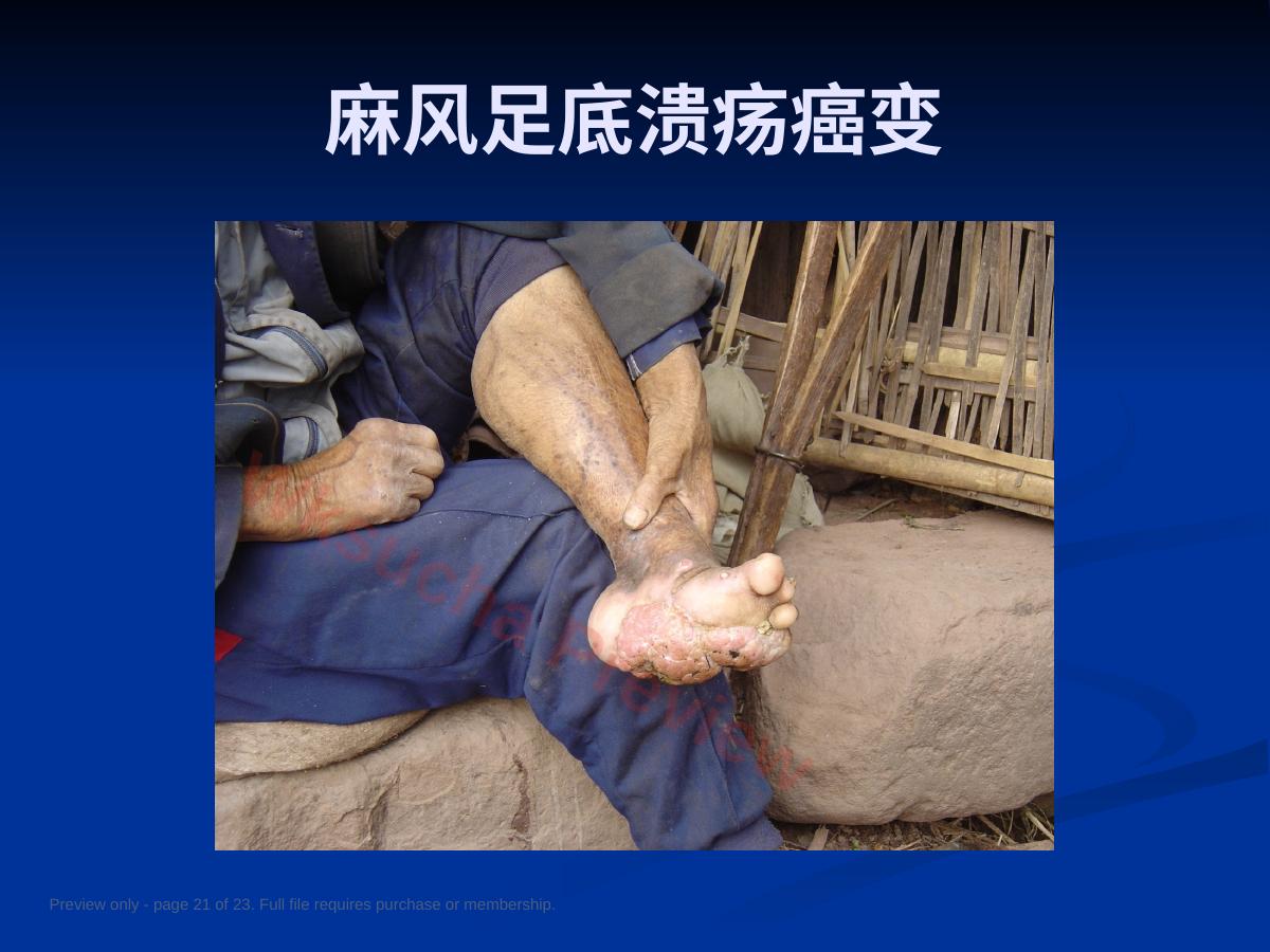 预览第 21 页