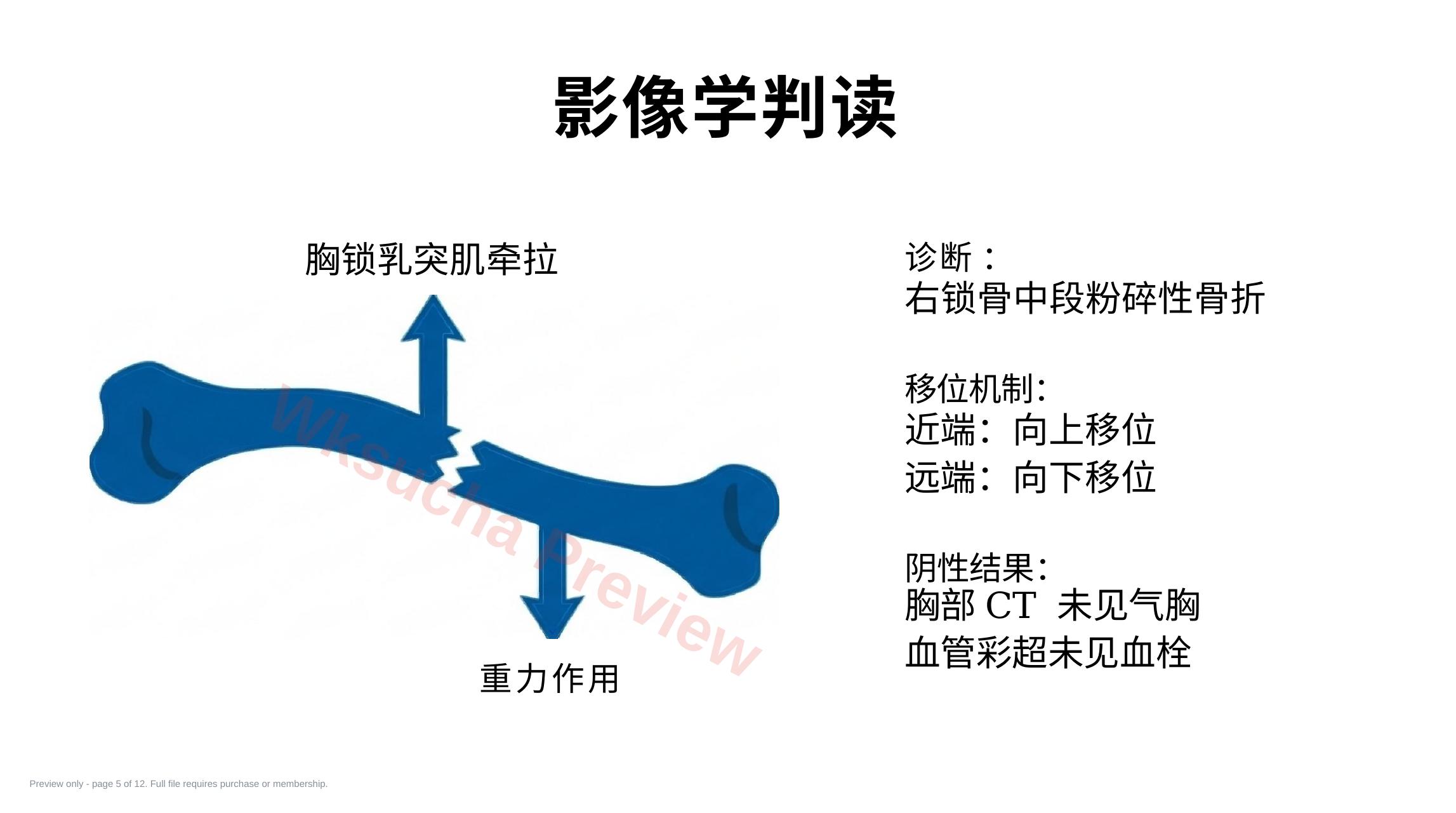 预览第 5 页