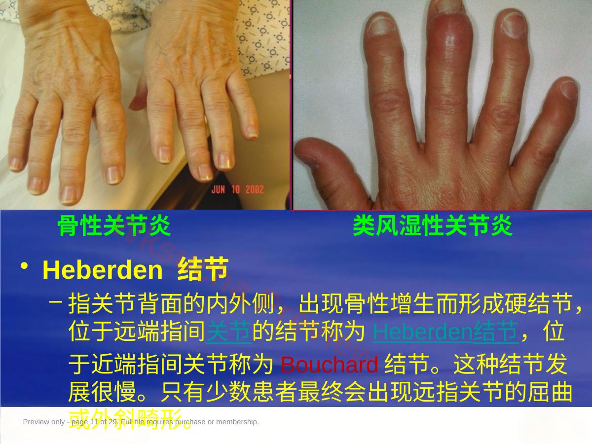 预览第 11 页