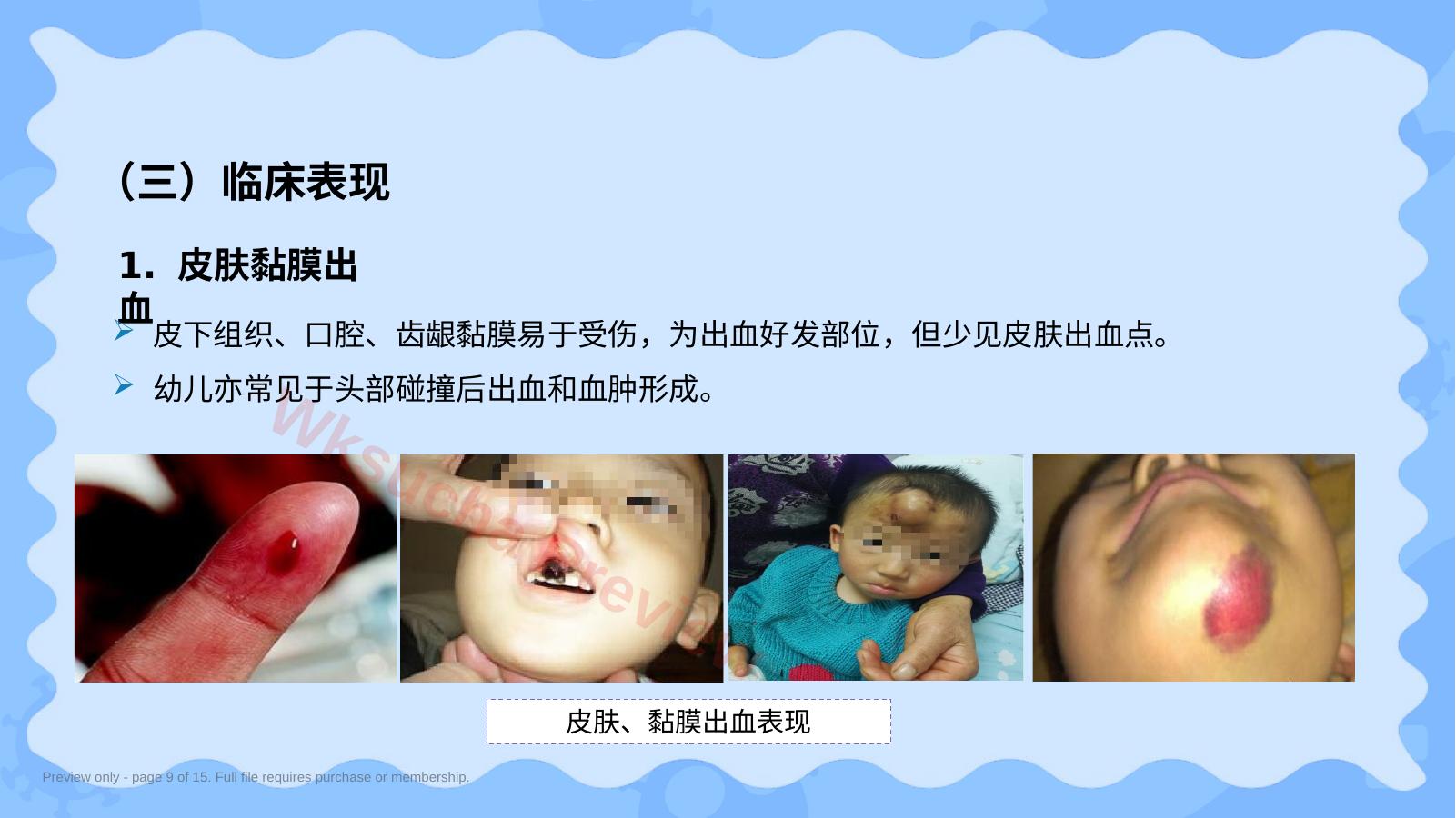 预览第 9 页