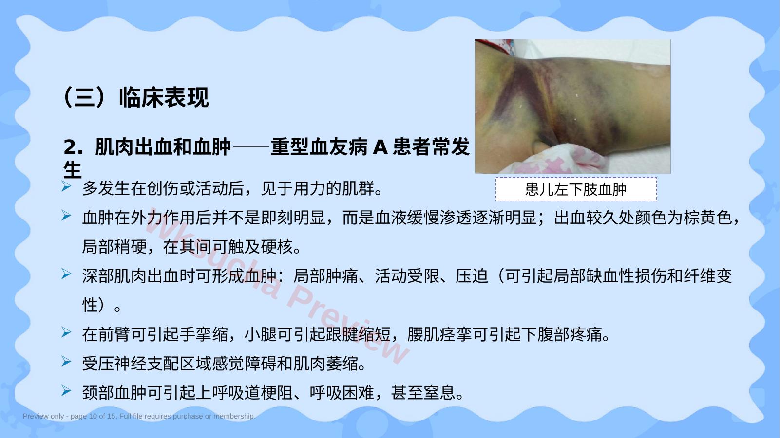 预览第 10 页