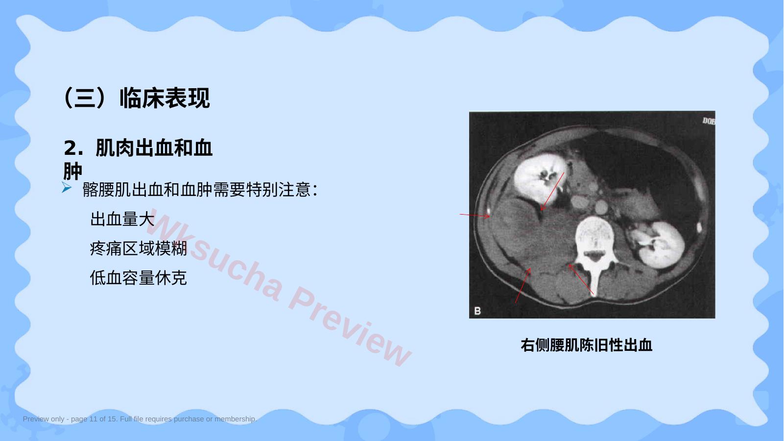 预览第 11 页