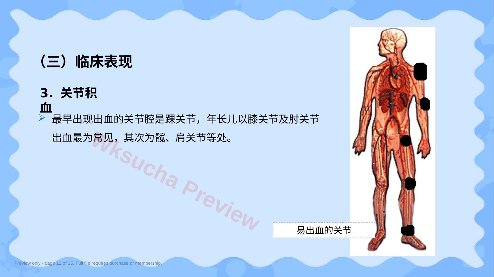 预览第 12 页