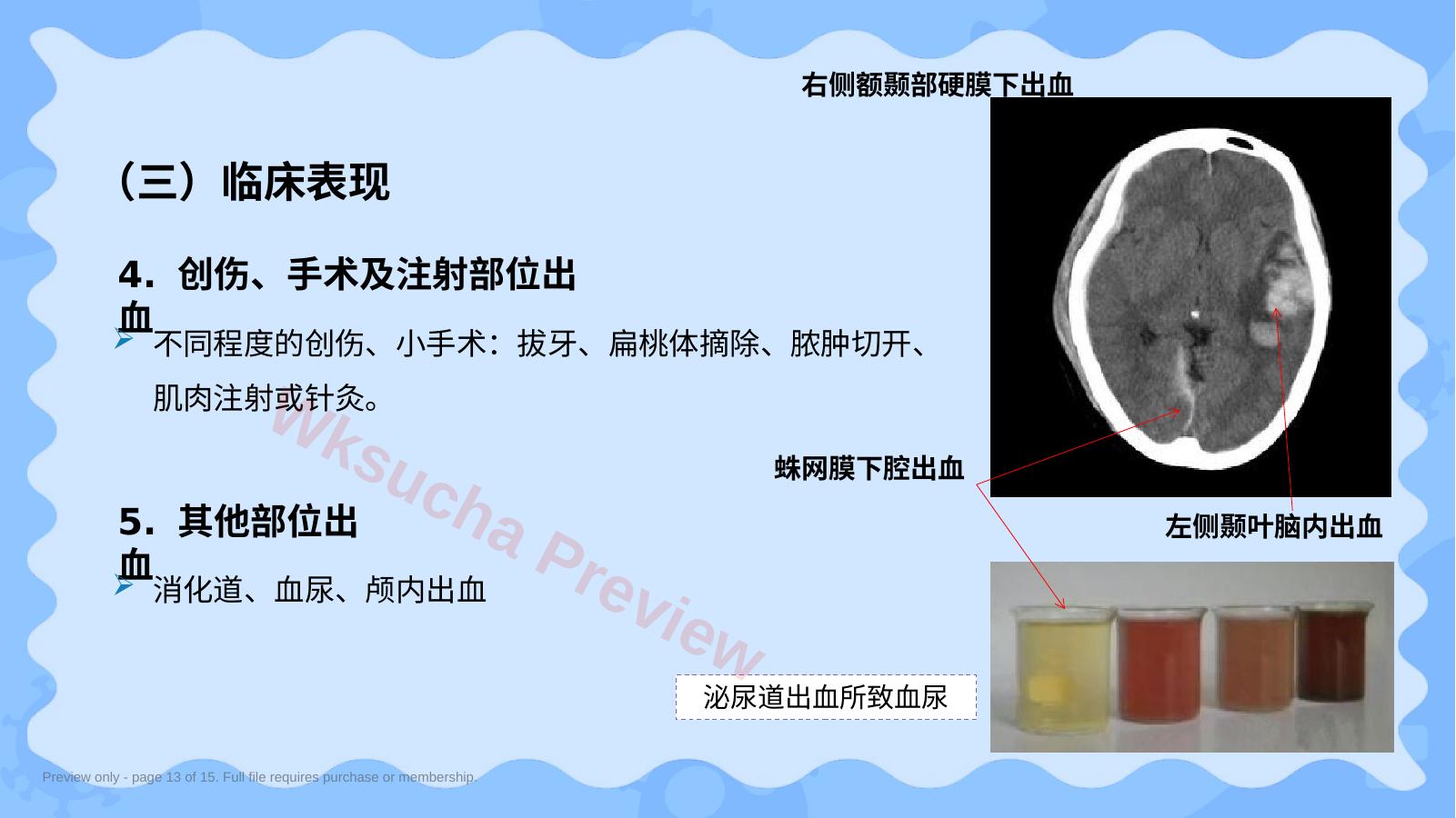 预览第 13 页