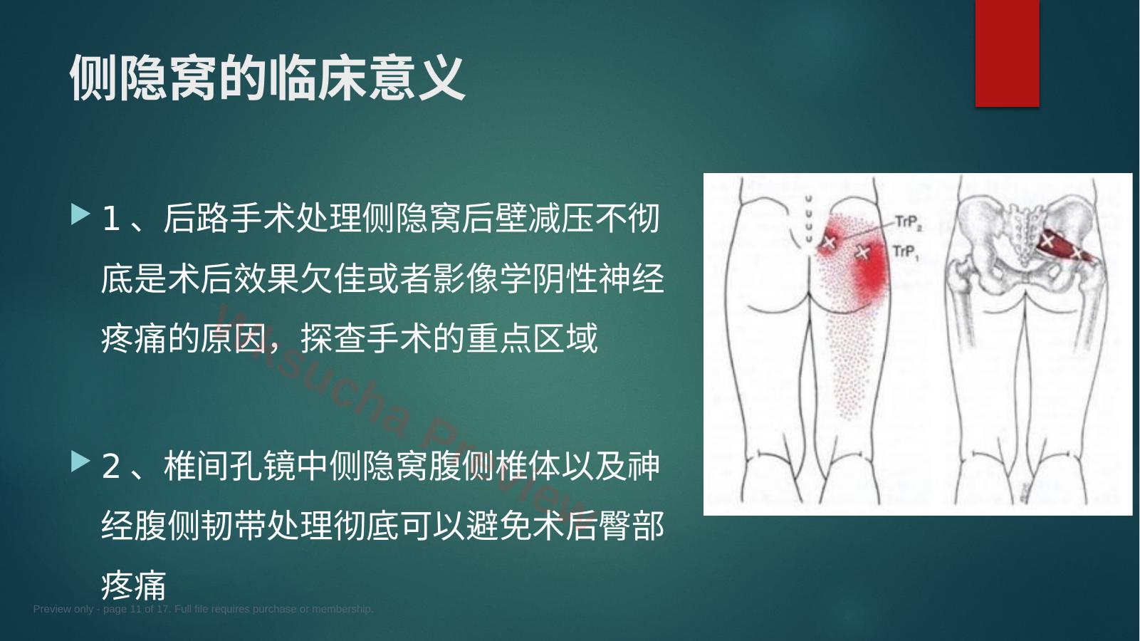 预览第 11 页