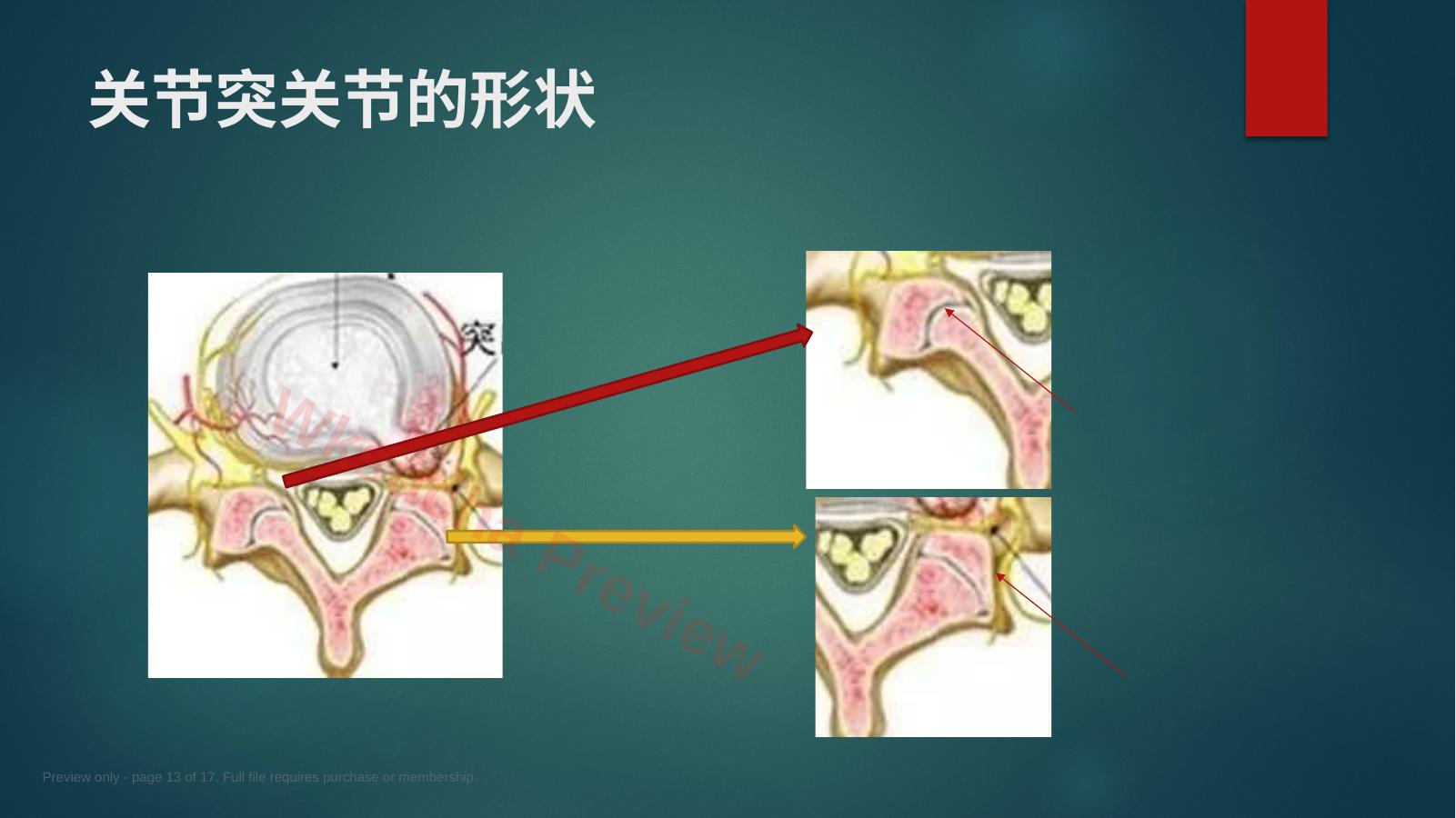 预览第 13 页