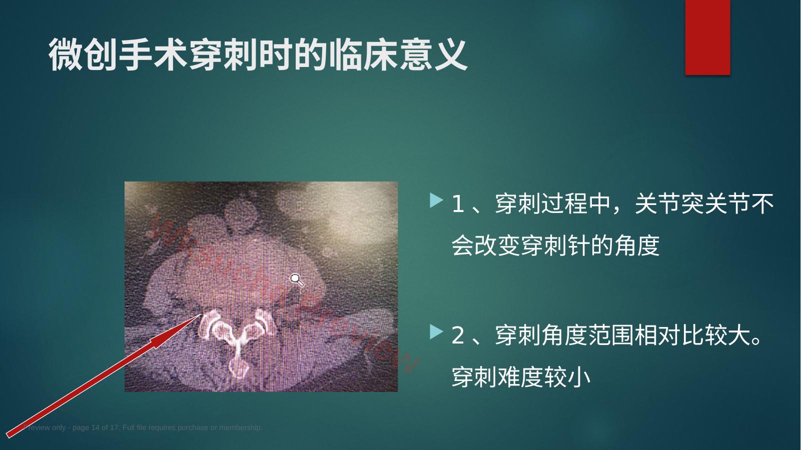 预览第 14 页