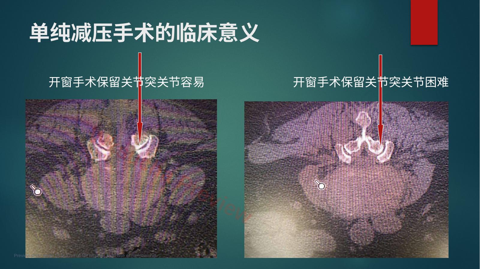 预览第 16 页