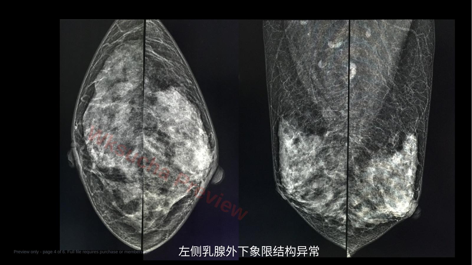 预览第 4 页