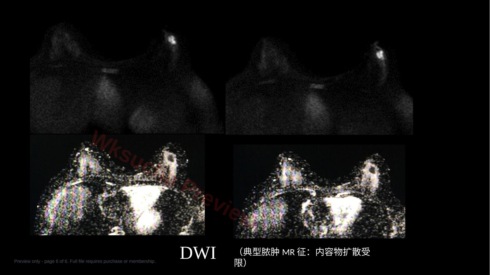 预览第 6 页