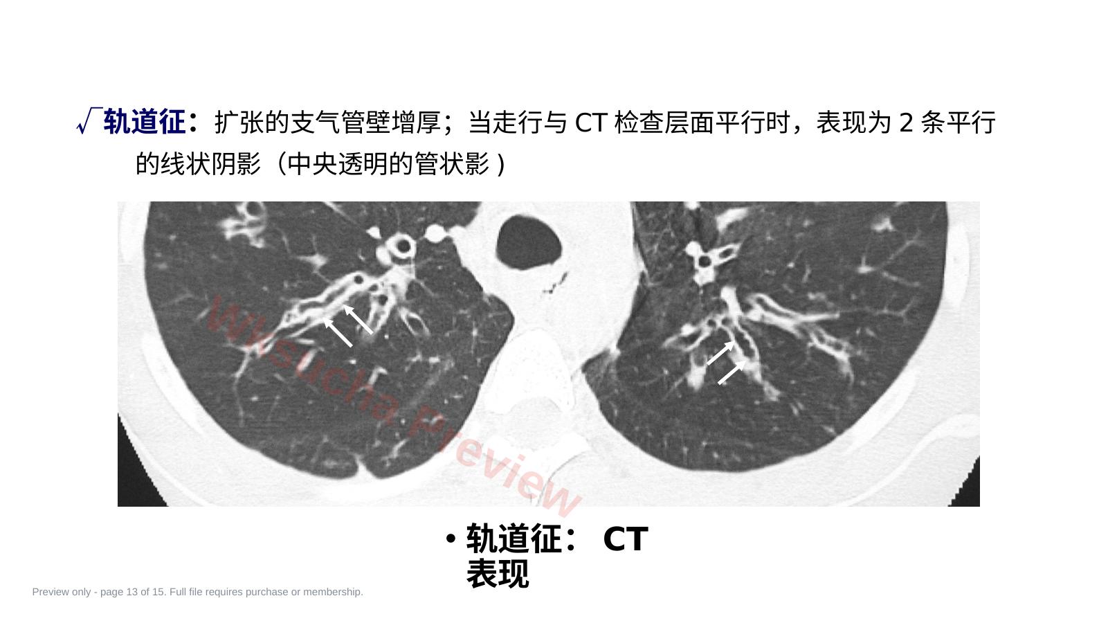 预览第 13 页