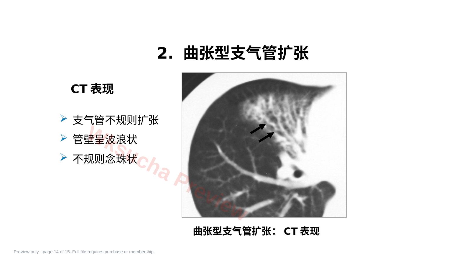 预览第 14 页