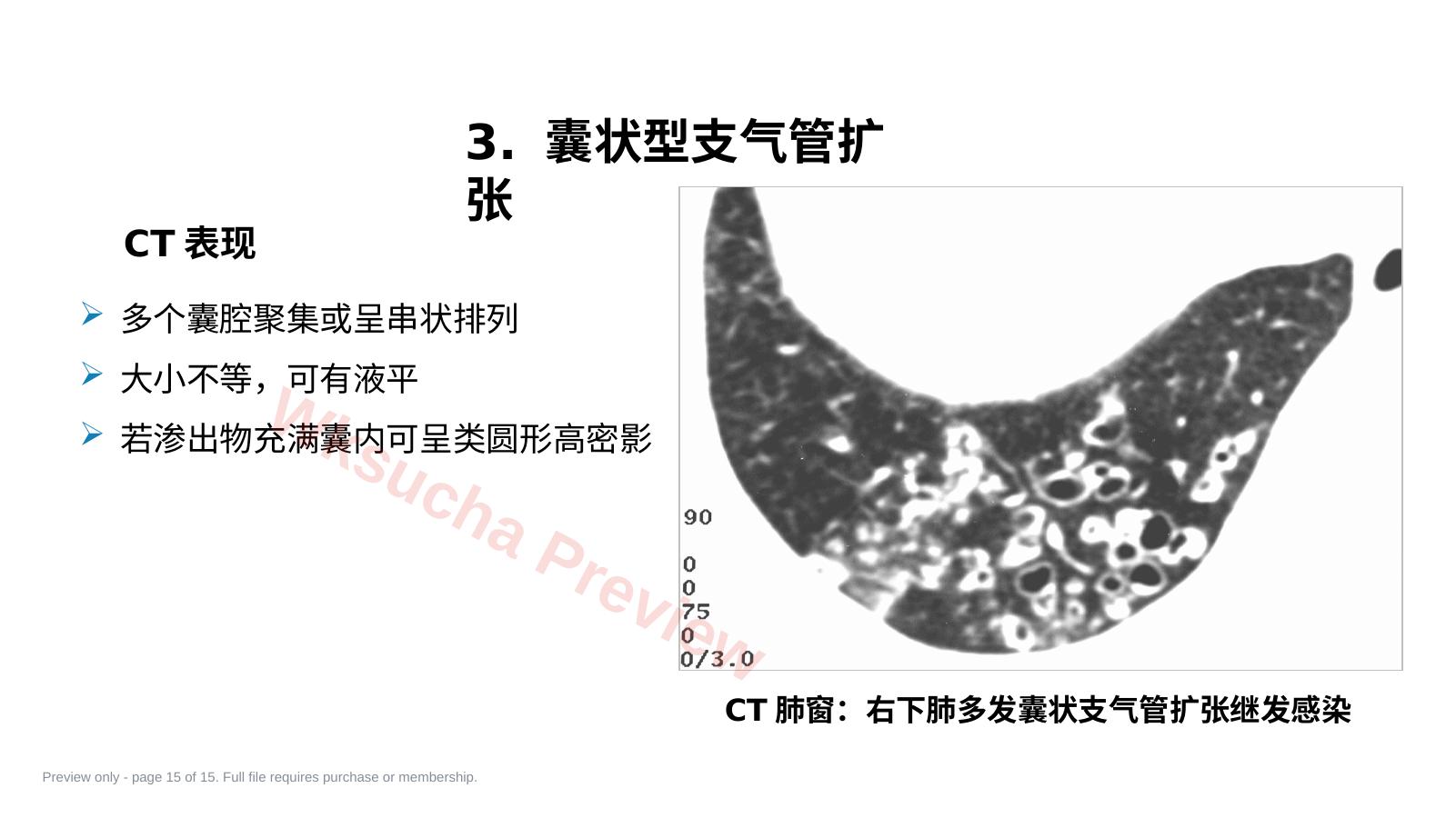预览第 15 页