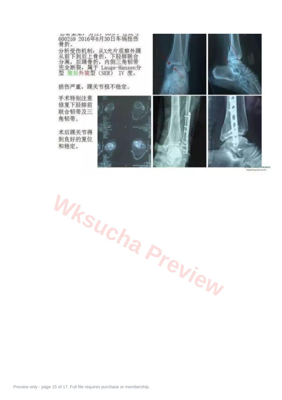 预览第 15 页