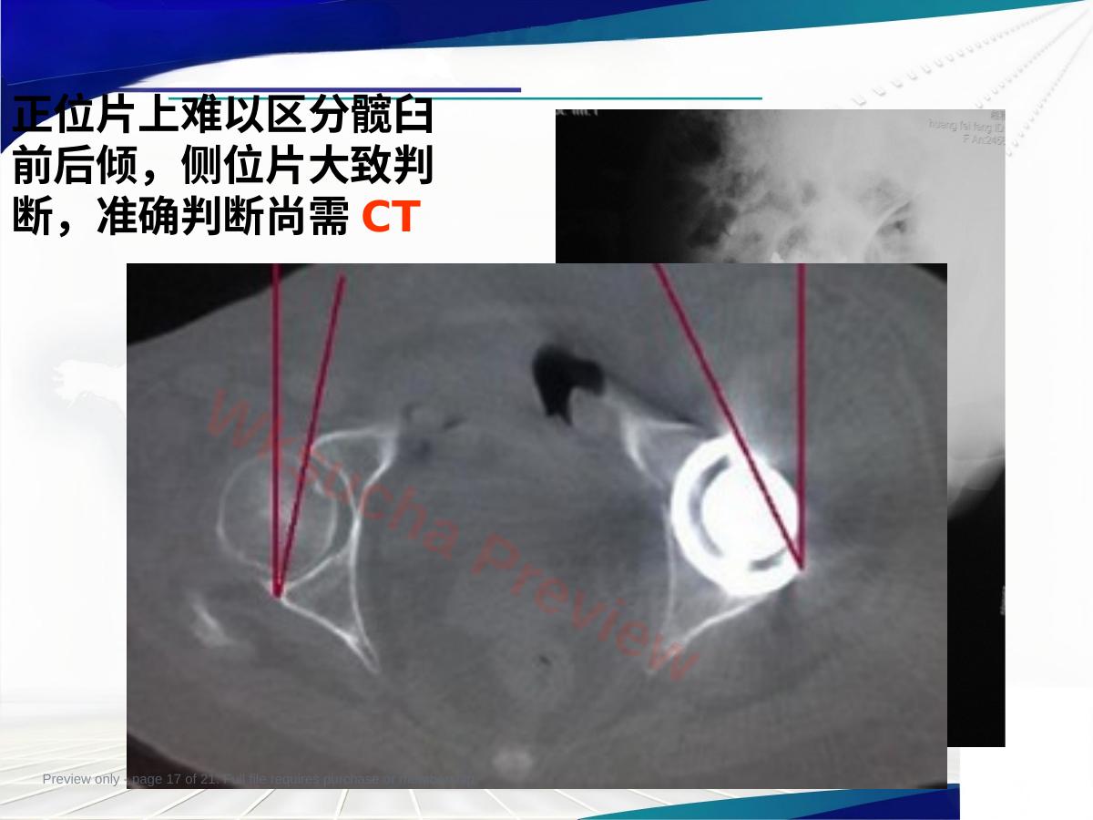 预览第 17 页