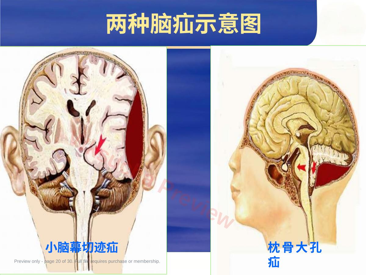 预览第 20 页