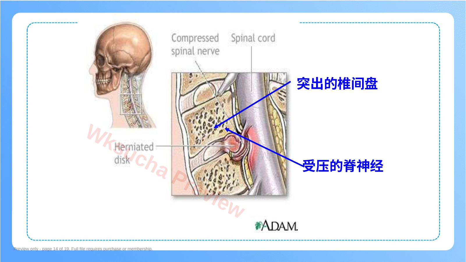 预览第 14 页