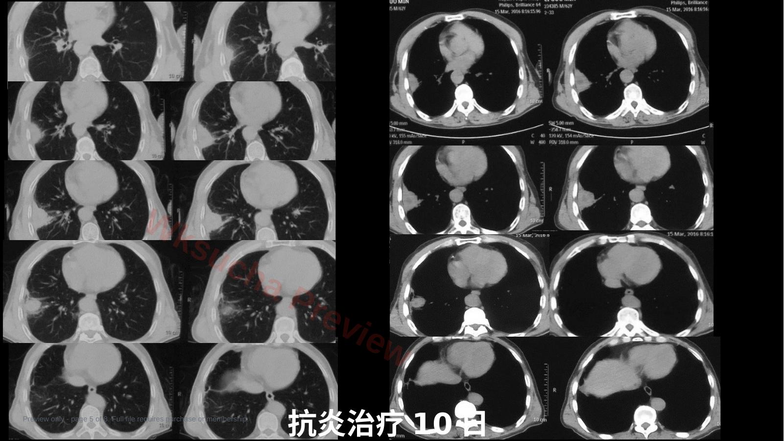 预览第 5 页