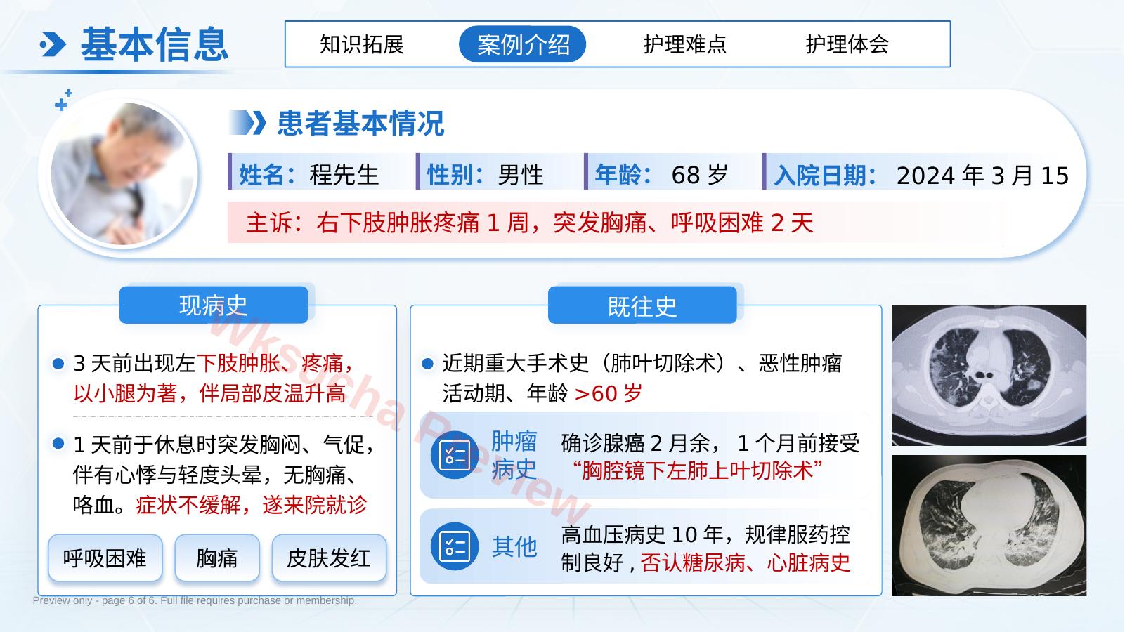 预览第 6 页