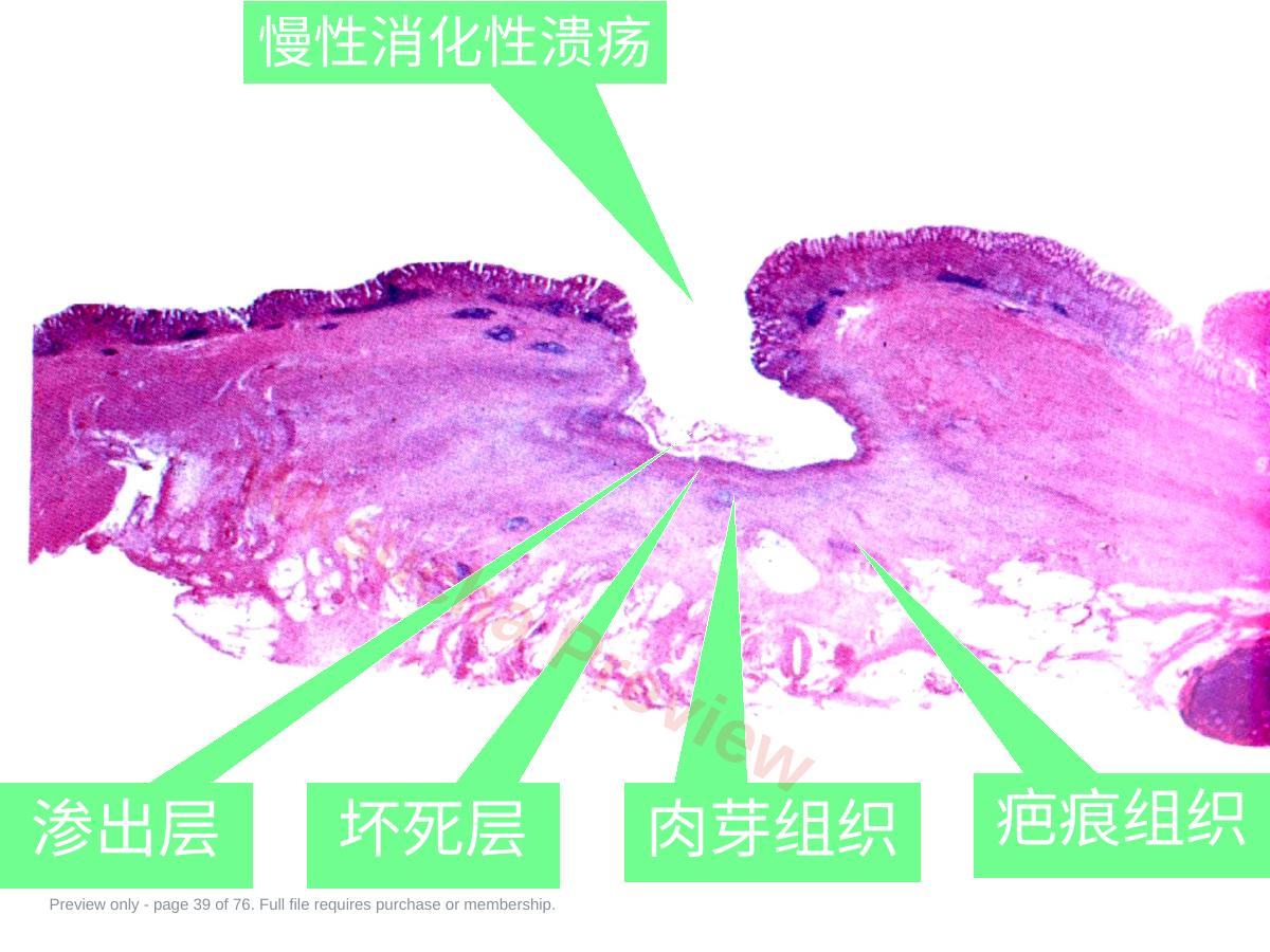 预览第 39 页