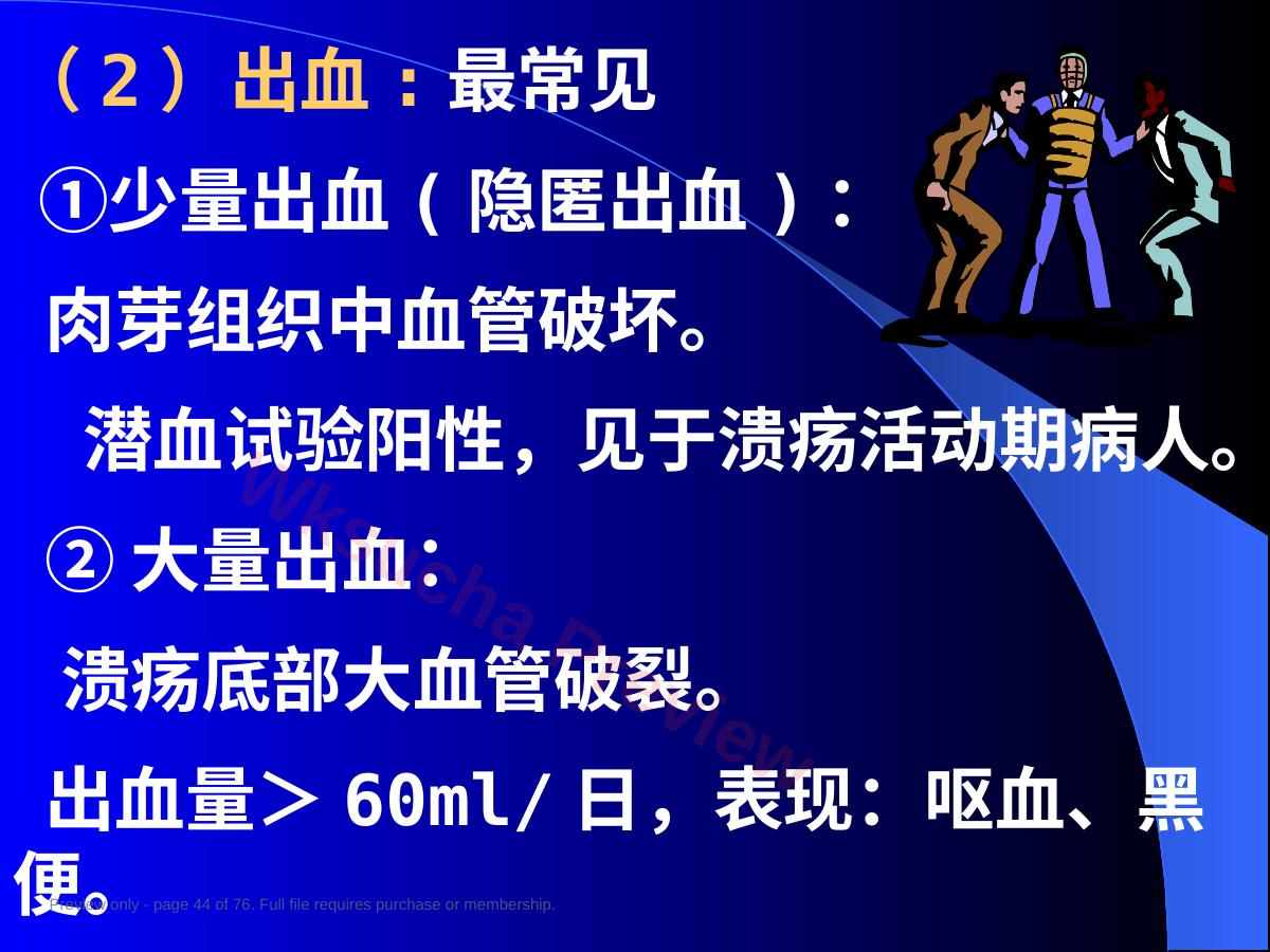 预览第 44 页