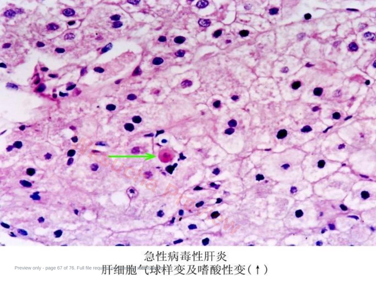 预览第 67 页