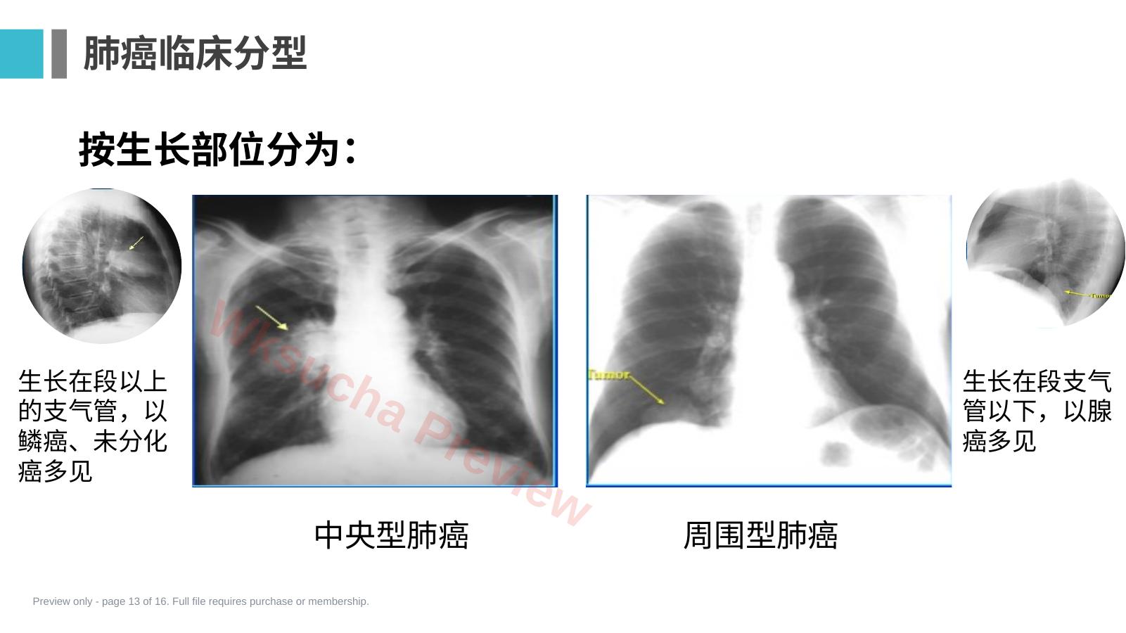 预览第 13 页