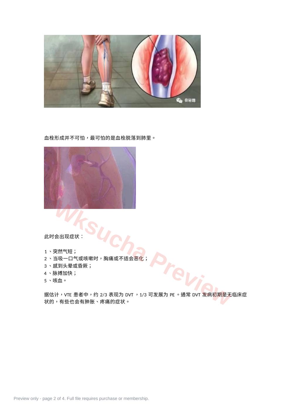 预览第 2 页