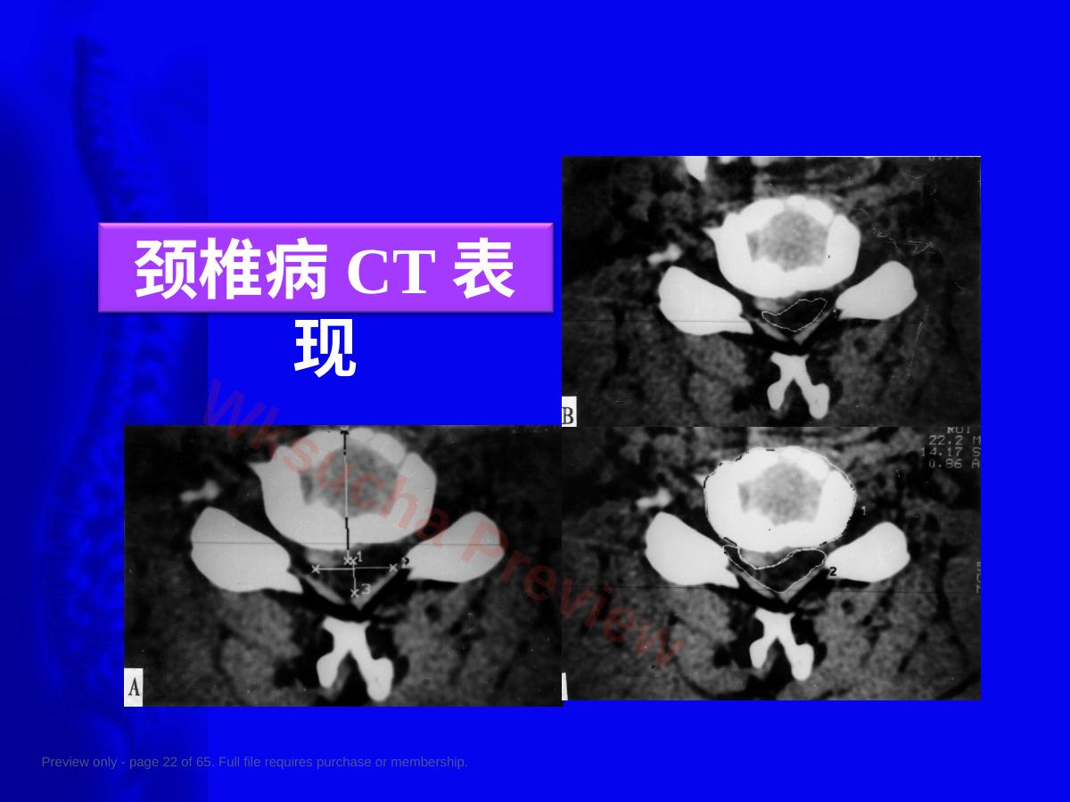 预览第 22 页