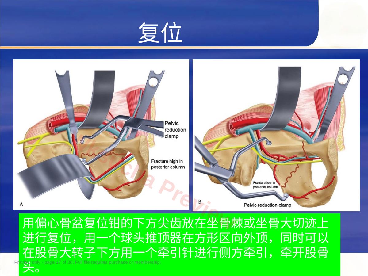 预览第 17 页