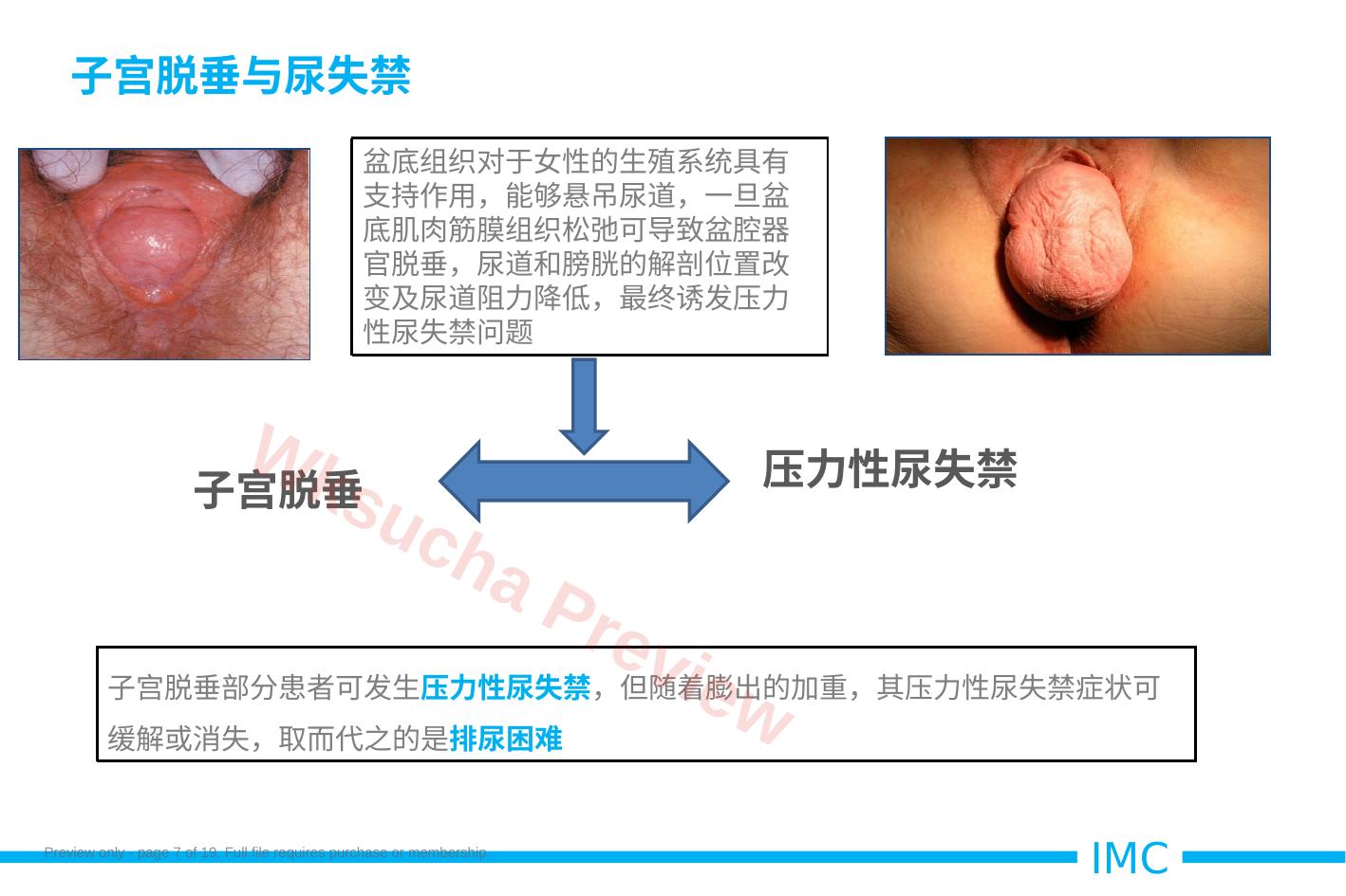 预览第 7 页