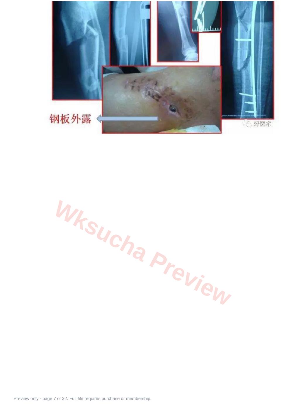 预览第 7 页
