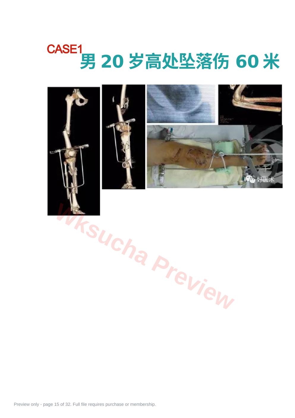预览第 15 页