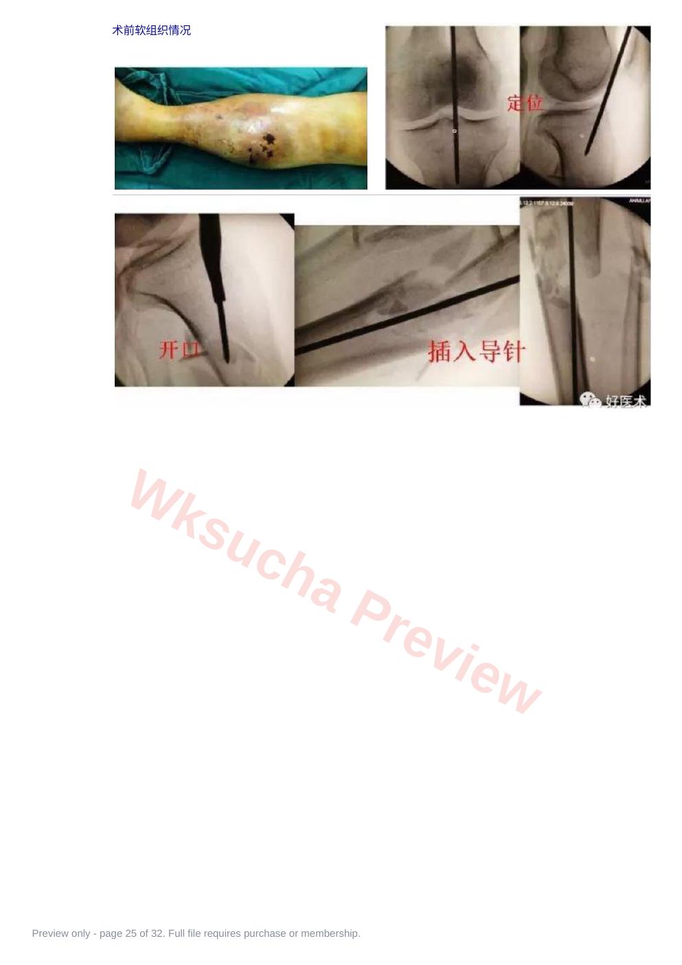 预览第 25 页