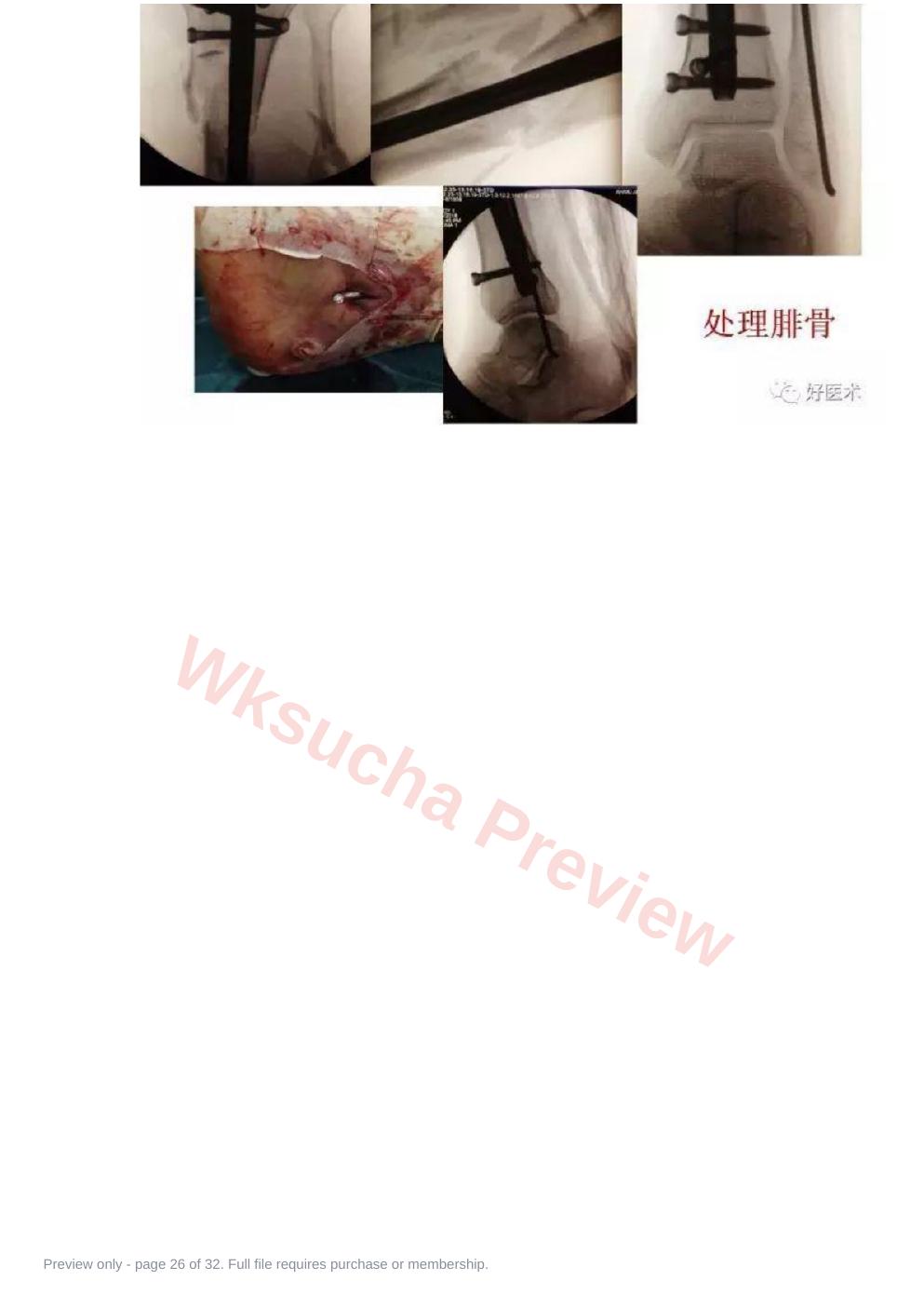 预览第 26 页