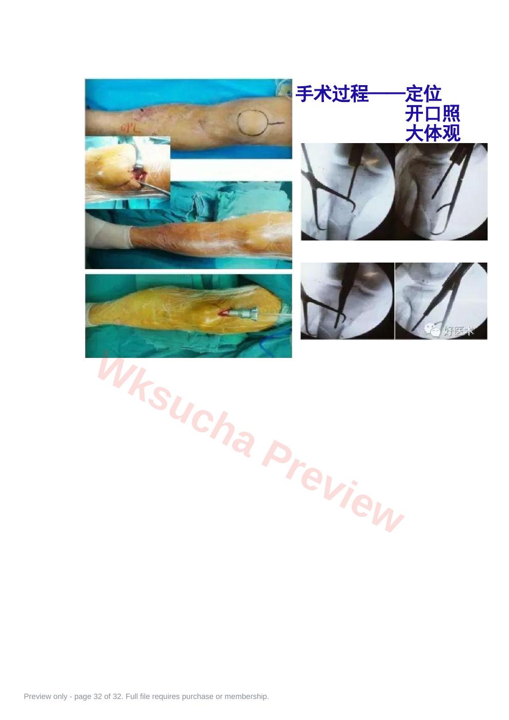 预览第 32 页