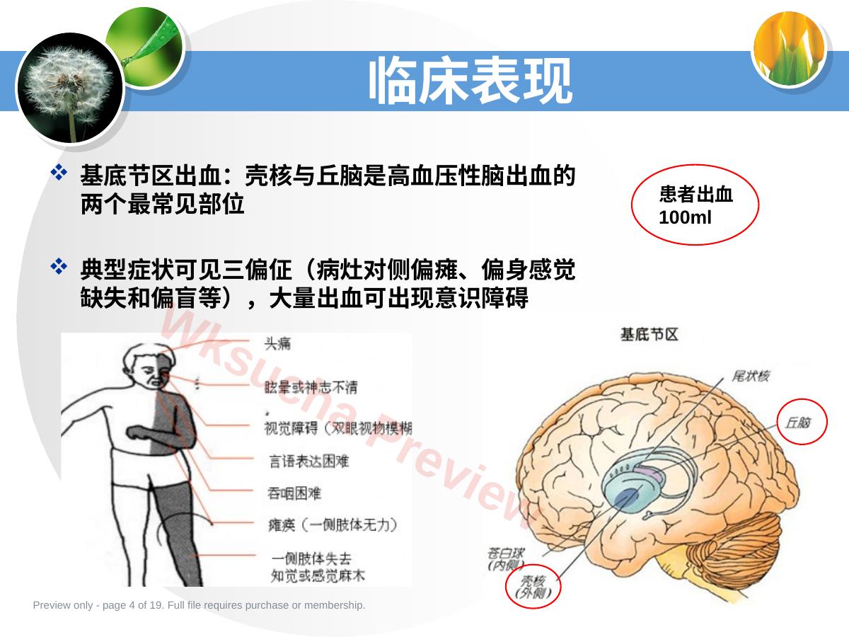 预览第 4 页